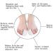 PEDIMEND Silicone Gel Toe Cap Sleeve + Silicone Gel Hammer Toe Straightener (2PAIR - 4PCS) - Overlapping Toe Nails - Prevent Painful Rubbing - Thumb Valgus Protector - Unisex - Foot Care - Buy Online on GoSupps.com