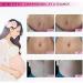 Mango Stretch Marks & Scar Cream (40g) | Pregnancy & Obesity Scar Removal - Wrinkle Reduction & Moisturizing - Buy Online on GoSupps.com