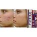 Mederma Ayurvedic Cream for Scars, Surgery, Injury, Burns, Acne & Cut Marks - 10g - Buy Online on GoSupps.com