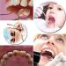 Dental Oral Kit - 3 Pcs Mirror Handle & Explorer Hook Pick for Oral Hygiene, Teeth Cleaning & Whitening - Buy Online on GoSupps.com