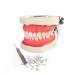 Vinbcorw Dental Care Model dentist for adult teeth Standard lessons with 24 removable teeth for teaching 12 * 9.5 cm of course