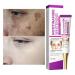 Cremas Para Las Manchas de La Cara Oscuras Para Eliminar Manchas en la Cara Crema Para Quitar Manchas de la Cara Crema Blanqueadora Para Pecas