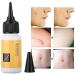 Scar Treatment Serum 20ml - Acne Scar Removal Cream for Smooth & Rejuvenated Skin - Buy Online on GoSupps.com