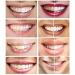 Teeth Sensitivity Relief Remineralization Gel - 3 x 3ml for Post-Whitening Care - Buy Online on GoSupps.com