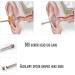 Luxxii 2 Pack Stainless Steel Double-Ended Ear Pick Earwax Removal Tools - Buy Online on GoSupps.com