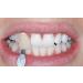Impressive Smile Teeth Whitening Pens 4 Pack - Professional Strength Gel for 120 Days - Buy Online on GoSupps.com