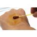 UBae 100pcs Disposable Medical Iodine Swab for Wound Care & Sterilization - Buy Online on GoSupps.com