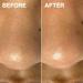 DERMAFLASH DERMAPORE Ultrasonic 2-in-1 Pore Extractor & Serum Infuser Tool - Icy Pink - Buy Online on GoSupps.com