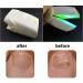 Rechargeable Nail Fungus Laser Treatment Onychomycosis Treatment for Onychomycosis Cure and Home Use - Buy Online on GoSupps.com