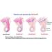 HerniaIN 3 Pack-NO Surgery NO Belt NO Tablet Essential Oil Blend Easy to Apply Tested for 50+ Years Natural Remedy for Hernias of Child Under 12 Try it for 1-2 Weeks Before Seeing a Doctor - Buy Online on GoSupps.com