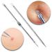 Great Value And Quality Skin Care Tools Set With Whiteheads / Blackheads / Acne Pimples Removers / Comedones Extractors By VAGA