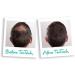 Hair Building Fibres for Thinning Hair (Golden Brown) - Buy Online on GoSupps.com