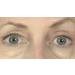 Butterfly Invisible Double Eye Lift - Instant Eye Lift Adhesive Strips - Buy Online on GoSupps.com
