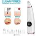 SMSOM Blackhead Remover Vacuum Portable Electric BlackheadRemoval Tools Pore Cleaner Extractor Facial Cleaner 6 Replacement Probes USB Rechargeable (Black) - Buy Online on GoSupps.com