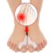 Bunion Cushion Protector 14-Pack - Bunion Corrector Pads with Separator for Big Toe - Gel Toe Shield for Foot Pain Relief - Reusable Gel Toe Protectors - Buy Online on GoSupps.com