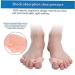 Allesoky Bunion Corrector Toe Alignment Tool - 5 Pairs | Soft Gel Separators for Foot Pain Relief, Toe Straightener Pads & Forefoot Support - Buy Online on GoSupps.com