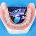 Teeth Whitening Kit: (10) Gels, (2) Trays, (1) Blue White LED Light - Easy At-Home Whitening for Brighter Smile & Fast Results - Buy Online on GoSupps.com
