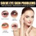 2024 New 4Pcs Instant Firming Eye Cream - Temporary Eye Tightener Eye Cream | Eye Cream for Dark Circles and Puffiness | Anti Aging Eye Bag Temporary Tightener Moisturize - 15ml/0.5fl.oz - Buy Online on GoSupps.com