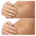 A'dorn Allure Scar Silicone Sheets - Surgical, Keloids, C-Section Tape - Buy Online on GoSupps.com