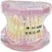 LBYLYH Pink Teeth Model - Orthodontic Dental Studio Educational Toy for Kids - Buy Online on GoSupps.com
