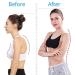 Posture Correction Back Shoulder Posture Correction Backrest Belt Adjustable Strap Spine Gray (Color : Skin Color Size : X-Large) vision Skin Color XL - Buy Online on GoSupps.com