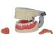Professional Dental Model for Incision & Drainage of Abscess - Ideal for Students & Educators | International Shipping - Buy Online on GoSupps.com