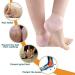 Buy Chrome Silicone Feet Care Socks - Moisturizing Gel Heel Protectors for Cracked Skin | Pink - International Shipping Available  - Buy Online on GoSupps.com