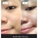 Buy Premium Acne Pads 36ct - ZitBeGone for Effective Acne Treatment | International Shipping Available - Buy Online on GoSupps.com