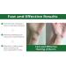 Dermalere Advanced Burn and Scar Cream - Fast Healing Face and Body Treatment - Scar Removal for Old & New Scars - Burns, Sunburns, Injuries & Surgery - Skin Irritation Relief - 1.35 oz - Buy Online on GoSupps.com
