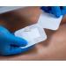 Moderex Sterile Adhesive Island Dressing with Absorbent Cotton Pad - 6x7cm x 25 Pack - Buy Online on GoSupps.com
