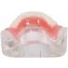 COMDS Dental Implant Model & Removable Dentures for Educational Use | 4 Nail Implant Demo Models - Buy Online on GoSupps.com
