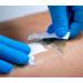 Sterile Waterproof Island Dressing x 25 - Latex Free, Transparent Border, 100% Cotton Absorbent pad - Buy Online on GoSupps.com