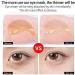 60 (30 pairs) Retinol Hyaluronic Acid Collagen Hydra-Gel Eye Pads/Patches Reduce Fine Lines and Wrinkles Dark Eyes Eye Bags Black Bags Crows Feet Smoother Fresher Looking Eyes and Skin - Buy Online on GoSupps.com