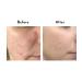 Lavido Natural Thera Intensive Clarifying Spot Treatment | Balance & Soothe Breakout-Prone Skin | 1.01 oz (30 mL) - Buy Internationally - Buy Online on GoSupps.com