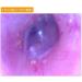 Luyila Ear Wax Removal Tool Set with 4.3 3.9mm Camera and Silicone Earwax Remover - Blue - Buy Online on GoSupps.com