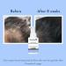 WishCare Hair Growth Serum Concentrate - 3% Redensyl 4% Anagain 2% Baicapil Caffeine Biotin Plant Keratin & Rice Water - Hair Growth Serum for Men & Women 30ml - Buy Online on GoSupps.com