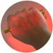 Vein Finder - Advanced Vein Illumination Device for Adults & Children | Easy Subcutaneous Vein Detection - Buy Online on GoSupps.com
