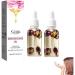 Lymphology Complex Body Oil - Anti-Cellulite & Lymphatic Drainage Massage Oil | Rose Petals Oil for Skin Tightening & Cellulite Reduction (2PC) - All Skin Types - Buy Online on GoSupps.com