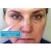 Instantly Ageless Jeunesse Anti-Aging Serum & Wrinkle Cream - Confidence Boosting Formula | 5 Pack - Buy Online on GoSupps.com