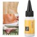 Scar Treatment Serum 20ml - Acne Scar Removal Cream for Smooth & Rejuvenated Skin - Buy Online on GoSupps.com