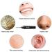 Yannies 3.9mm WiFi Ear Wax Removal Endoscope 5MP Camera - Pink | Portable Visual Ear Cleaner for Adults, Kids & Pets - Buy Online on GoSupps.com