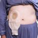 Buy Economical Drainable Ostomy Bags for Colostomy & Ileostomy - 20-60mm Stoma Care Pouches Worldwide Shipping - Buy Online on GoSupps.com