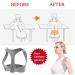 DFHBFG Posture Back Corrector Belt - Clavicle & Spine Support for Improved Comfort | Small Size - Buy Online on GoSupps.com