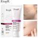 RtopR Mango Deep Cleansing Peeling Gel Whitening Moisturizing Face Peeling Cream Cleanser Acne Blackhead Acne Gel Cream - Buy Online on GoSupps.com