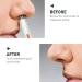 Professional Painless Ear & Nose Hair Trimmer - USB Rechargeable Easy to Use & Clean Unisex Grooming Tool - Buy Online on GoSupps.com