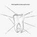 MOMOQ 6 in 1 Dental Tools Remove Plaque and Tartar Teeth Cleaning Tools Set Stainless Steel Dental Hygiene Oral Care Kit with Case - Buy Online on GoSupps.com