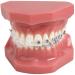 Supports teeth model tipodonto dental with mental brackets orthodontics teeth model treatment with ligature red tie with anti-nail red
