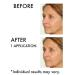 NassifMD Hydro-Screen Hyaluronic Acid Face Serum | Ceramide & Retinol Moisturizer | Anti Aging & Hydrating Formula - 2 Fl Oz - Buy Online on GoSupps.com