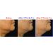 WHITESILK Derma Volufiline 5-Minute Restore Cream Balm Stick - High Concentration for Firm, Plump, Lifted Skin - Hydrating and Brightening Face, Eyes, Lips, Neck, and Body - Buy Online on GoSupps.com