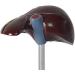 Human Liver Pathological Model with Base On Support Tool Study On Medical Model Internal - Buy Online on GoSupps.com